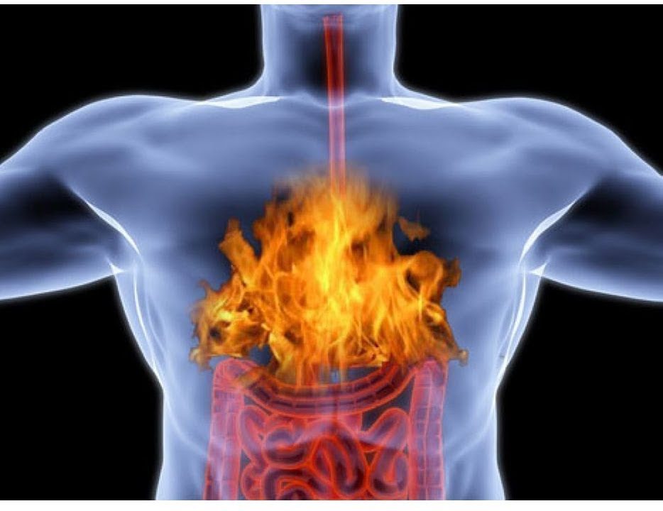 Лечение изжоги народными средствами, допустимо или нет?