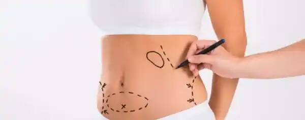 Say Goodbye to Stubborn Fat: Exploring the Magic of Fat Dissolving Injections