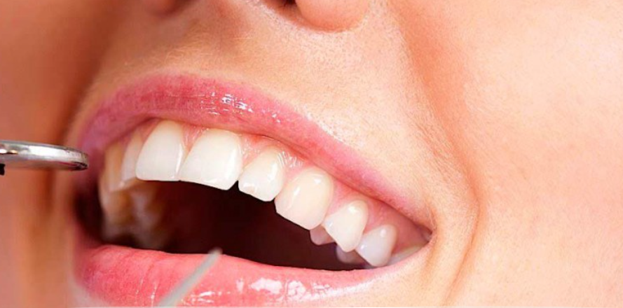 Плазмолифтинг дёсен: всё, что нужно знать о революционном методе восстановления здоровья полости рта